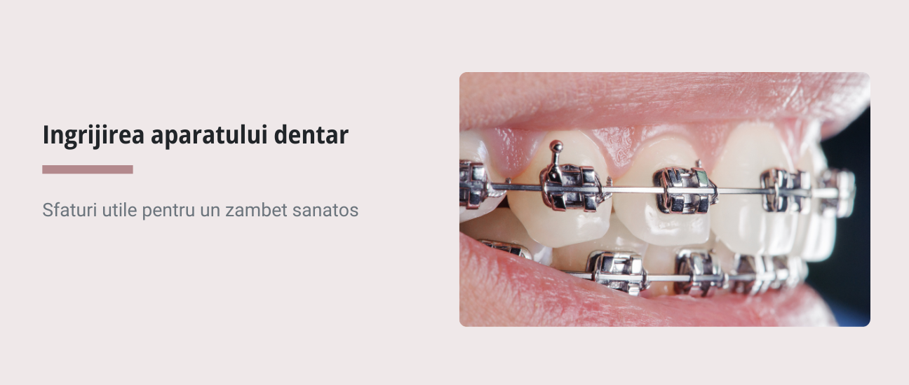 Ingrijirea aparatului dentar