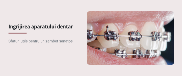 Ingrijirea aparatului dentar