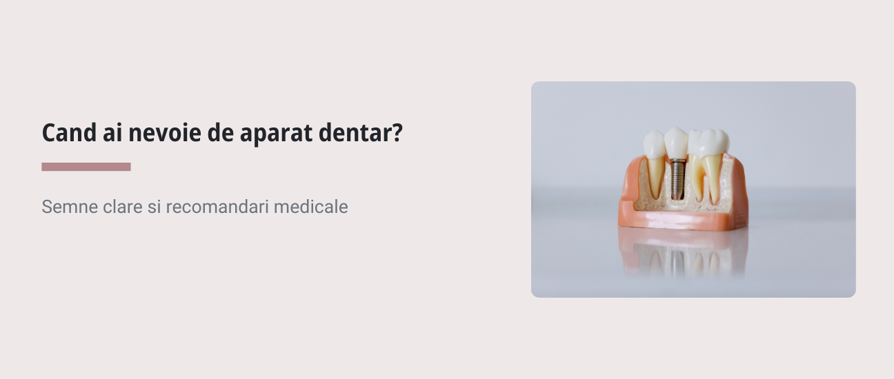 Cand e momentul sa porti aparat dentar?