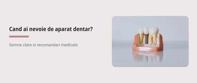 Cand e momentul sa porti aparat dentar?